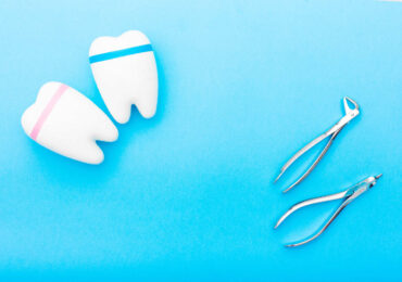 Tooth Extraction at Dental Solutions in HSR Layout