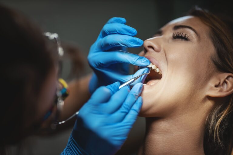 Dental Filling at Dental Solutions HSR Layout