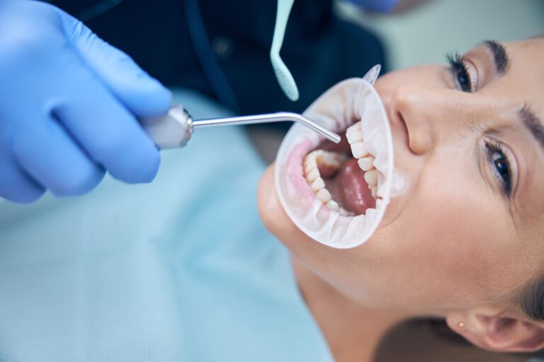 Dental Filling at Dental Solutions HSR Layout
