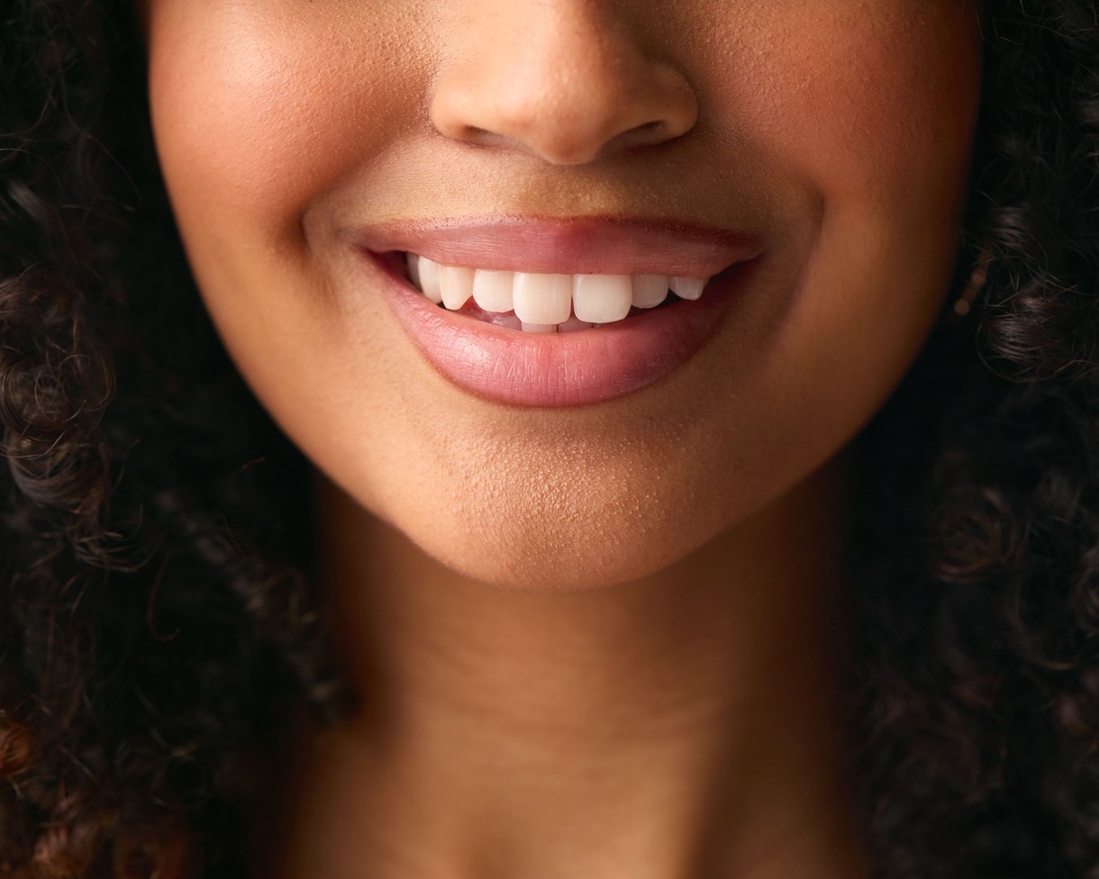 Successful Root canal treatment at Dental Solutions HSR Layout