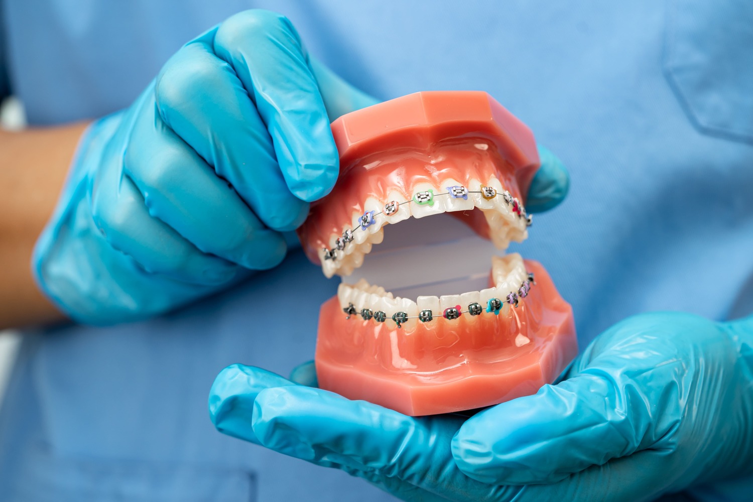 Tooth alignment demo at Dental Solutions HSR Layout